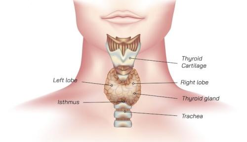Symptoms of an overactive thyroid