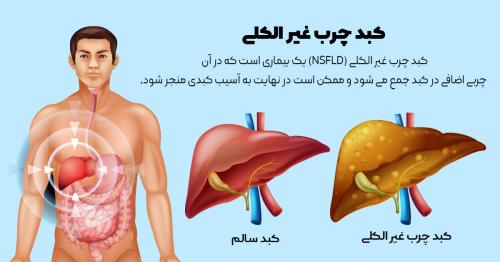 مدت زمان پاکسازی کبد با خاکشیر