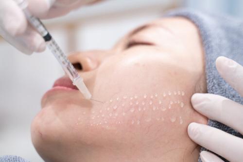 همه چیز درباره مزوتراپی